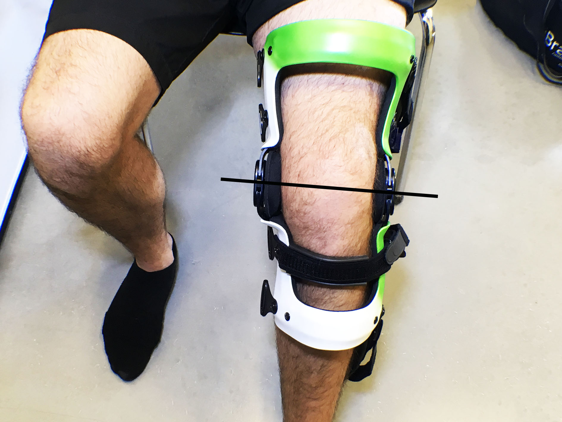 should you leave a knee brace on overnight