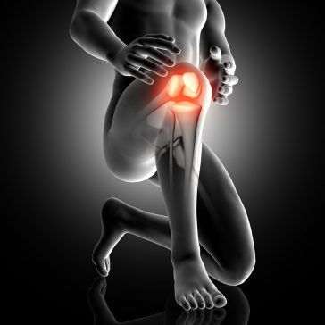 ARTHROSIS or wear of the KNEE Why it happens and how it is SOLVED  Physiolution 